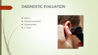 DAIGNOSTIC EVALUATION
 History
 Physical examination
 Tympanometry
 C T Scan
 