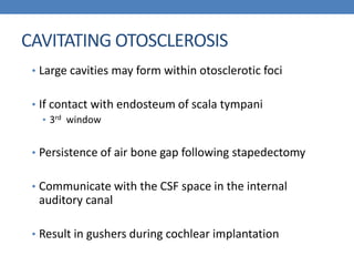 CAVITATING OTOSCLEROSIS
• Large cavities may form within otosclerotic foci
• If contact with endosteum of scala tympani
• 3rd window
• Persistence of air bone gap following stapedectomy
• Communicate with the CSF space in the internal
auditory canal
• Result in gushers during cochlear implantation
 