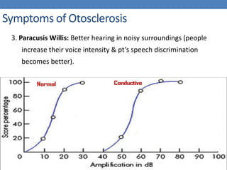 Symptoms of Otosclerosis
3. Paracusis Willis: Better hearing in noisy surroundings (people
increase their voice intensity & pt’s speech discrimination
becomes better).
 