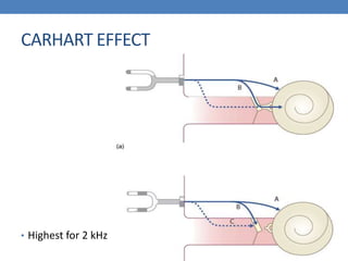 CARHART EFFECT
• Highest for 2 kHz
 