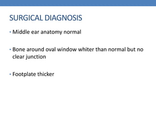 SURGICAL DIAGNOSIS
• Middle ear anatomy normal
• Bone around oval window whiter than normal but no
clear junction
• Footplate thicker
 