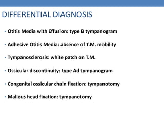 DIFFERENTIAL DIAGNOSIS
• Otitis Media with Effusion: type B tympanogram
• Adhesive Otitis Media: absence of T.M. mobility
• Tympanosclerosis: white patch on T.M.
• Ossicular discontinuity: type Ad tympanogram
• Congenital ossicular chain fixation: tympanotomy
• Malleus head fixation: tympanotomy
 