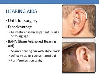 HEARING AIDS
• Unfit for surgery
• Disadvantage
• Aesthetic concern as patient usually
of young age
• BAHA (Bone Anchored Hearing
Aid)
• An only hearing ear with otosclerosis
• Difficulty using a conventional aid
• Post-fenestration cavity
 