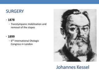 SURGERY
• 1878
• Transtympanic mobilization and
removal of the stapes
• 1899
• 6th International Otologic
Congress in London
Johannes Kessel
 