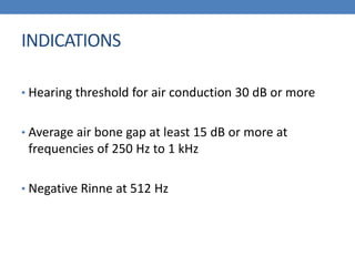 INDICATIONS
• Hearing threshold for air conduction 30 dB or more
• Average air bone gap at least 15 dB or more at
frequencies of 250 Hz to 1 kHz
• Negative Rinne at 512 Hz
 