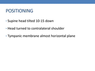 POSITIONING
• Supine head tilted 10-15 down
• Head turned to contralateral shoulder
• Tympanic membrane almost horizontal plane
 