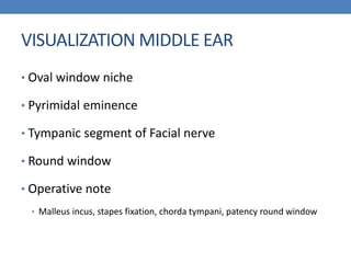 VISUALIZATION MIDDLE EAR
• Oval window niche
• Pyrimidal eminence
• Tympanic segment of Facial nerve
• Round window
• Operative note
• Malleus incus, stapes fixation, chorda tympani, patency round window
 