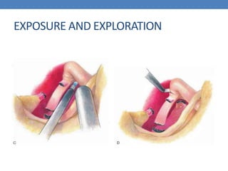 EXPOSURE AND EXPLORATION
 