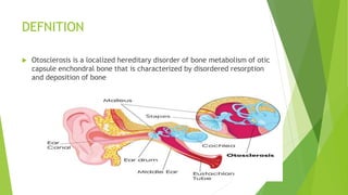 DEFNITION
 Otosclerosis is a localized hereditary disorder of bone metabolism of otic
capsule enchondral bone that is characterized by disordered resorption
and deposition of bone
 