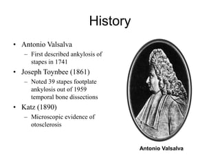History
• Antonio Valsalva
– First described ankylosis of
stapes in 1741
• Joseph Toynbee (1861)
– Noted 39 stapes footplate
ankylosis out of 1959
temporal bone dissections
• Katz (1890)
– Microscopic evidence of
otosclerosis
Antonio Valsalva
 