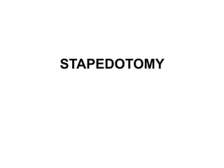 STAPEDOTOMY
 