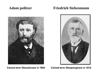 Adam politzer Friedrich Siebenmann
Coined term Otosclerosis in 1894 Coined term Otospongiosis in 1912
 