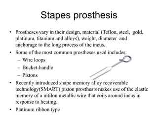 Stapes prosthesis
• Prostheses vary in their design, material (Teflon, steel, gold,
platinum, titanium and alloys), weight, diameter and
anchorage to the long process of the incus.
• Some of the most common prostheses used includes:
– Wire loops
– Bucket-handle
– Pistons
• Recently introduced shape memory alloy recoverable
technology(SMART) piston prosthesis makes use of the elastic
memory of a nitilon metallic wire that coils around incus in
response to heating.
• Platinum ribbon type
 