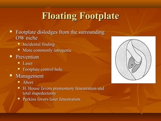 Floating Footplate
   Footplate dislodges from the surrounding
    OW niche
       Incidental finding
       More commonly iatrogenic
   Prevention
       Laser
       Footplate control hole
   Management
       Abort
       H. House favors promontory fenestration and
        total stapedectomy
       Perkins favors laser fenestration
 