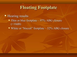 Floating Footplate
   Hearing results
       Thin or blue footplate – 97% ABG closure
        (<10dB)
       White or “biscuit” footplate – 52% ABG closure
 