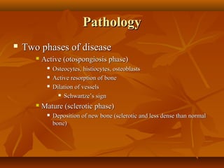 Pathology
   Two phases of disease
          Active (otospongiosis phase)
               Osteocytes, histiocytes, osteoblasts
               Active resorption of bone
               Dilation of vessels
                   Schwartze’s sign

          Mature (sclerotic phase)
               Deposition of new bone (sclerotic and less dense than normal
                bone)
 