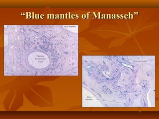 “Blue mantles of Manasseh”
 