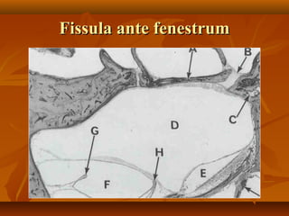 Fissula ante fenestrum
 