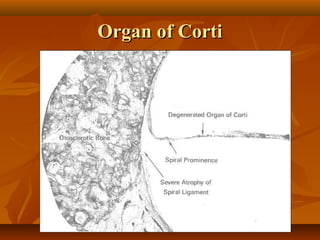 Organ of Corti
 