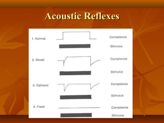 Acoustic Reflexes
 
