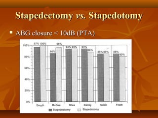 Stapedectomy vs. Stapedotomy
   ABG closure < 10dB (PTA)
 