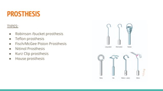 Clinical features, investigation, and management of Otosclerosis | PDF