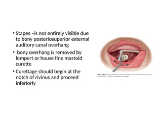 otosclerosis.pptent ppT clinical features eyiology pathogenesis | PPTX