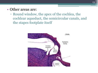• Other areas are:
▫ Round window, the apex of the cochlea, the
cochlear aqueduct, the semicircular canals, and
the stapes footplate itself
13
 