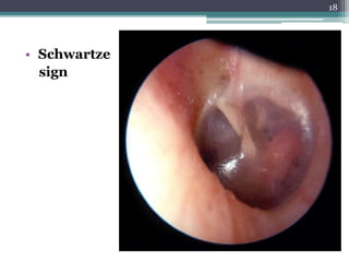 • Schwartze
sign
18
 