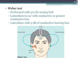 • Weber test
▫ Performed with 512 Hz tuning fork
▫ Lateralizes to ear with conductive or greater
conductive loss
▫ Lateralizes with 5 dB of conductive hearing loss
19
 