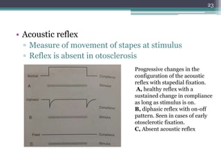 • Acoustic reflex
▫ Measure of movement of stapes at stimulus
▫ Reflex is absent in otosclerosis
23
Progressive changes in the
configuration of the acoustic
reflex with stapedial fixation.
A, healthy reflex with a
sustained change in compliance
as long as stimulus is on.
B, diphasic reflex with on-off
pattern. Seen in cases of early
otosclerotic fixation.
C, Absent acoustic reflex
 