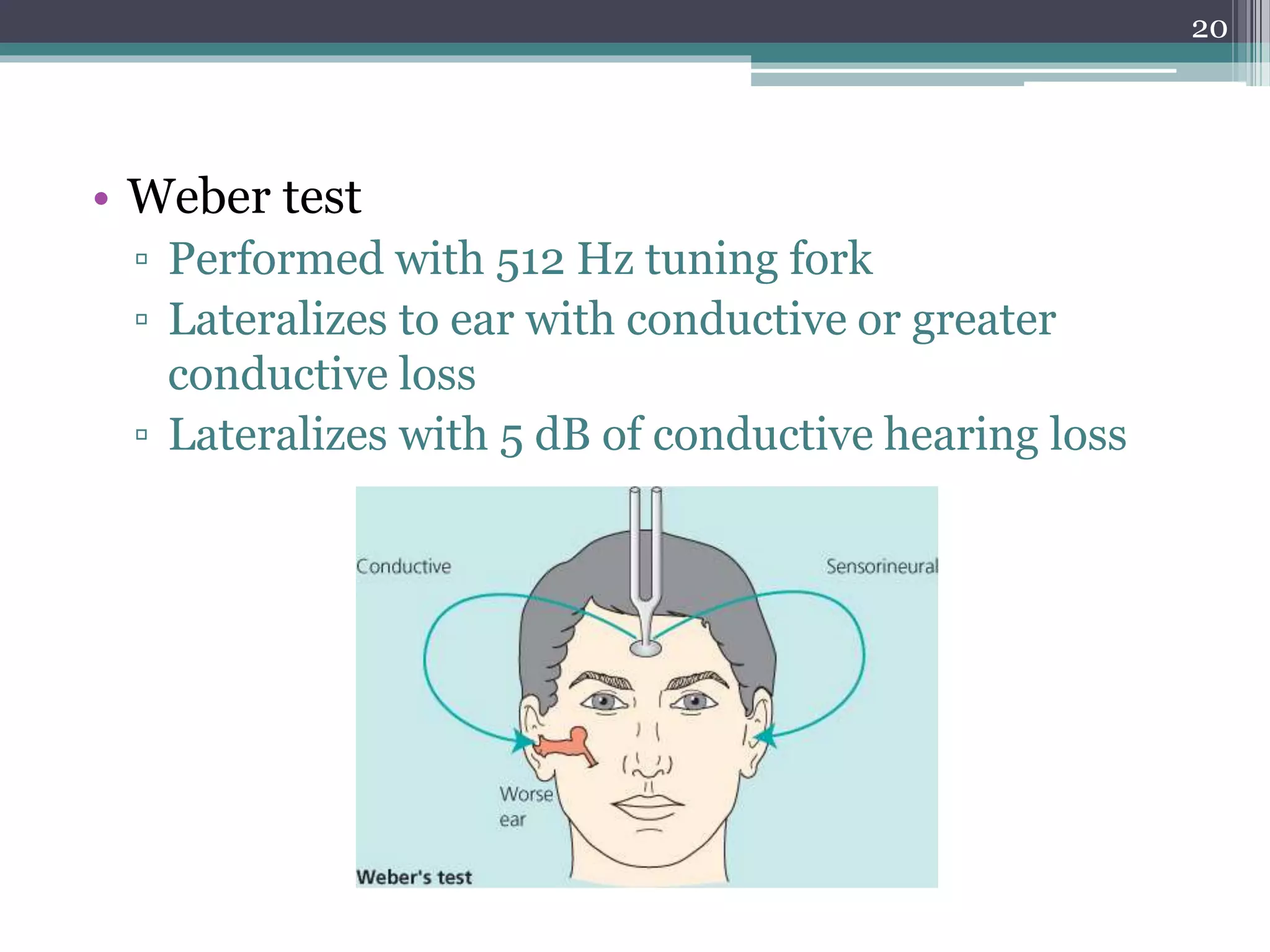 Otosclerosis ENT | PPTX