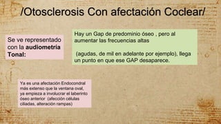 /Otosclerosis Con afectación Coclear/
Se ve representado
con la audiometría
Tonal:
Hay un Gap de predominio óseo , pero al
aumentar las frecuencias altas
(agudas, de mil en adelante por ejemplo), llega
un punto en que ese GAP desaparece.
Ya es una afectación Endocondral
más extenso que la ventana oval,
ya empieza a involucrar el laberinto
óseo anterior (afección células
ciliadas, alteración rampas)
 