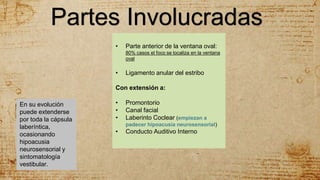 Partes Involucradas
• Parte anterior de la ventana oval:
80% casos el foco se localiza en la ventana
oval
• Ligamento anular del estribo
Con extensión a:
• Promontorio
• Canal facial
• Laberinto Coclear (empiezan a
padecer hipoacusia neurosensorial)
• Conducto Auditivo Interno
En su evolución
puede extenderse
por toda la cápsula
laberíntica,
ocasionando
hipoacusia
neurosensorial y
sintomatología
vestibular.
 