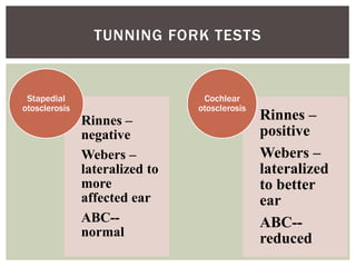 Otosclerosis | PPTX