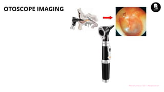 Mindfulness 101 | Meditation
OTOSCOPE IMAGING
 