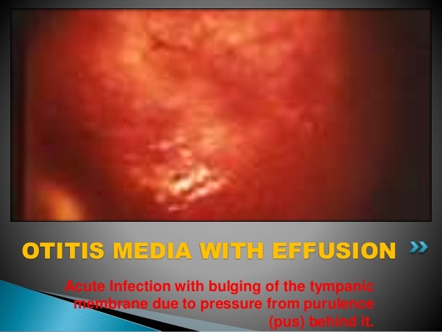 Ears Nose Throat Flashcards