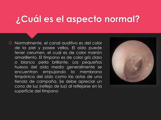 Otoscopia | PPTX