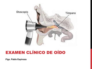 EXAMEN CLÍNICO DE OÍDO
Flgo. Pablo Espinoza

 