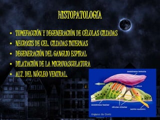 HISTOPATOLOGÍA
•   TUMEFACCIÓN Y DEGENERACIÓN DE CÉLULAS CILIADAS
•   NECROSIS DE CEL. CILIADAS INTERNAS
•   DEGENERACIÓN DEL GANGLIO ESPIRAL
•   DILATACIÓN DE LA MICROVASCULATURA
•   ALT. DEL NÚCLEO VENTRAL.
 