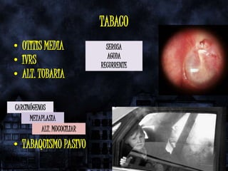 TABACO
• OTITIS MEDIA                SEROSA
                              AGUDA
• IVRS                      RECURRENTE
• ALT. TUBARIA

CARCINÓGENOS
      METAPLASIA
          ALT. MUCOCILIAR

• TABAQUISMO PASIVO
 