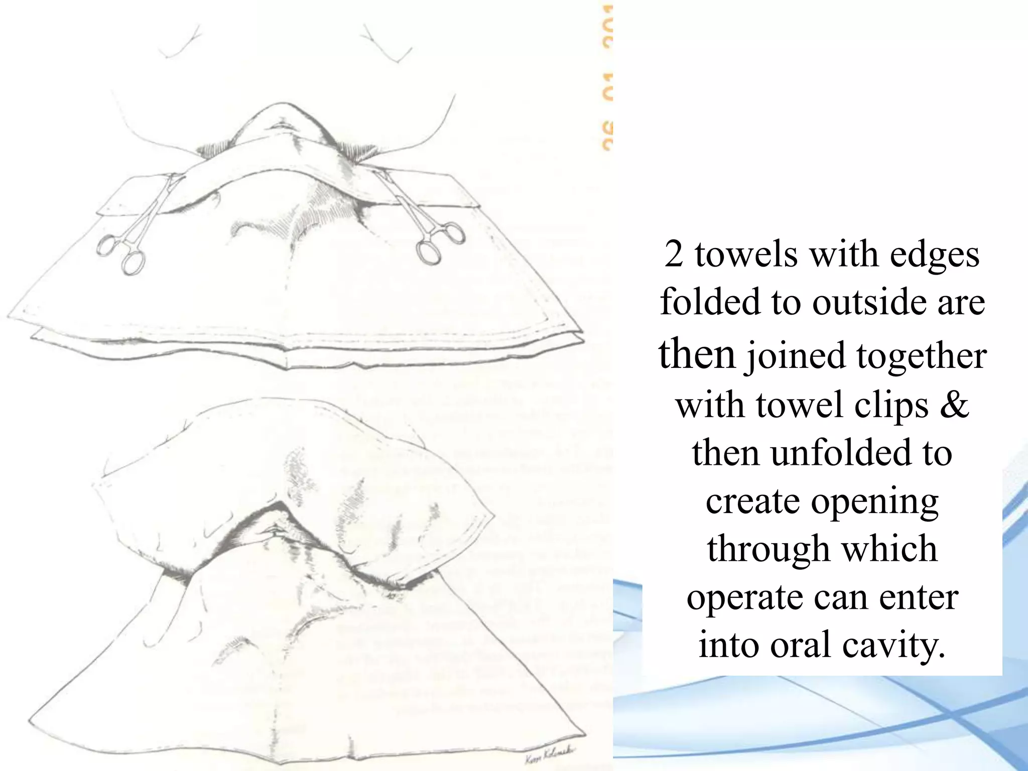 2 towels with edges
folded to outside are
then joined together
with towel clips &
then unfolded to
create opening
through which
operate can enter
into oral cavity.

 