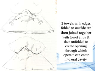 2 towels with edges
folded to outside are
then joined together
with towel clips &
then unfolded to
create opening
through which
operate can enter
into oral cavity.

 