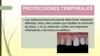 PROTECCIONES TEMPORALES
Las restauraciones provisional debe tener márgenes
definidos, lisos, bien pulidos que faciliten la remoción
de placa y no su retención, evitar una respuesta
inflamatoria y favorezca la estética.
 