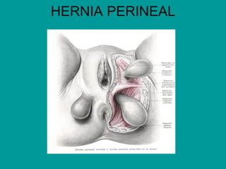 HERNIA PERINEAL
