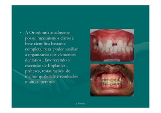 O QUE É ORTOGNÁTICA? – Alexandre Augusto Ferreira da Silva