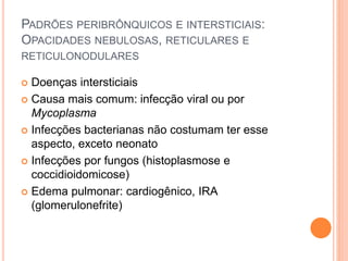 PADRÕES PERIBRÔNQUICOS E INTERSTICIAIS:
OPACIDADES NEBULOSAS, RETICULARES E
RETICULONODULARES
 Doenças intersticiais
 Causa mais comum: infecção viral ou por
Mycoplasma
 Infecções bacterianas não costumam ter esse
aspecto, exceto neonato
 Infecções por fungos (histoplasmose e
coccidioidomicose)
 Edema pulmonar: cardiogênico, IRA
(glomerulonefrite)
 