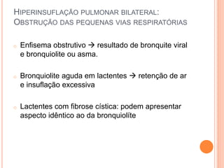 HIPERINSUFLAÇÃO PULMONAR BILATERAL:
OBSTRUÇÃO DAS PEQUENAS VIAS RESPIRATÓRIAS
o Enfisema obstrutivo  resultado de bronquite viral
e bronquiolite ou asma.
o Bronquiolite aguda em lactentes  retenção de ar
e insuflação excessiva
o Lactentes com fibrose cística: podem apresentar
aspecto idêntico ao da bronquiolíte
 