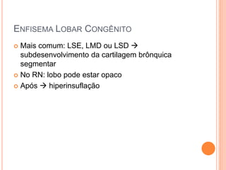 ENFISEMA LOBAR CONGÊNITO
 Mais comum: LSE, LMD ou LSD 
subdesenvolvimento da cartilagem brônquica
segmentar
 No RN: lobo pode estar opaco
 Após  hiperinsuflação
 