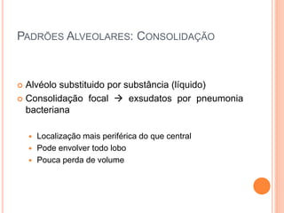 PADRÕES ALVEOLARES: CONSOLIDAÇÃO
 Alvéolo substituido por substância (líquido)
 Consolidação focal  exsudatos por pneumonia
bacteriana
 Localização mais periférica do que central
 Pode envolver todo lobo
 Pouca perda de volume
 